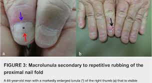 Image result for lunula nail