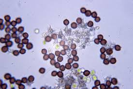 Attēlu rezultāti vaicājumam “Didymium squamulosum macro”