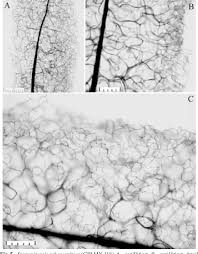Attēlu rezultāti vaicājumam “Stemonaria irregularis”