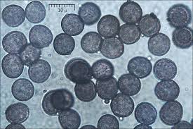 Attēlu rezultāti vaicājumam “Fuligo septica var. flava spores”