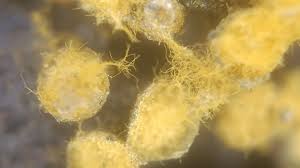 Attēlu rezultāti vaicājumam “Trichia scabra spores”