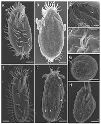 Attēlu rezultāti vaicājumam “Heterotrichia oerstedii (syn. Arcyria oerstedii) stalked”
