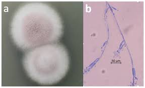 Attēlu rezultāti vaicājumam “Badhamia lilacina spores”
