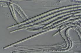 Attēlu rezultāti vaicājumam “Stictis”