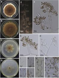 Attēlu rezultāti vaicājumam “Stemonitopsis aequalis var. microspora”