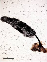 Attēlu rezultāti vaicājumam “Comatricha meandrispora stalked”