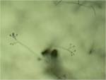 File:<b>Verticillium</b>