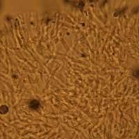 Attēlu rezultāti vaicājumam “Penicillium vulpinum”