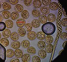 Attēlu rezultāti vaicājumam “Trichia longipalpis sessile”