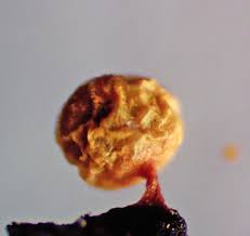 Attēlu rezultāti vaicājumam “Lycogala fuscoolearium young”