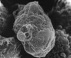 Image result for фотография вируса вич