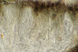 Attēlu rezultāti vaicājumam “Arthonia byssacea”