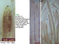 Attēlu rezultāti vaicājumam “Vibrissea decolorans”