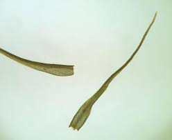 Attēlu rezultāti vaicājumam “Pleuridium subulatum”