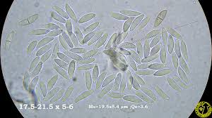 Attēlu rezultāti vaicājumam “Cudoniella acicularis”
