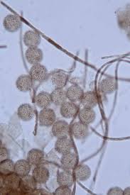 Attēlu rezultāti vaicājumam “Lamproderma ovoideum spores”