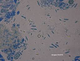 Attēlu rezultāti vaicājumam “Microcalicium disseminatum”