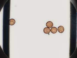 Attēlu rezultāti vaicājumam “Physarum bryomacrocarpum spores”