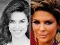 celebrity plastic surgery 2011