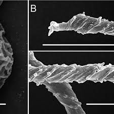 Attēlu rezultāti vaicājumam “Trichia scabra spores”