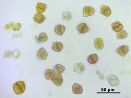 Attēlu rezultāti vaicājumam “Lophozia longidens”