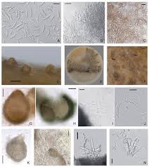 Attēlu rezultāti vaicājumam “Dianema nivale spores”