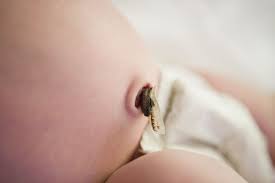 Attēlu rezultāti vaicājumam “Diderma umbilicatum young”