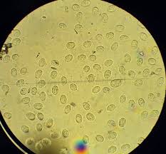 Attēlu rezultāti vaicājumam “Ceratiomyxa fruticulosa spores”