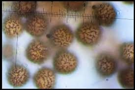 Attēlu rezultāti vaicājumam “Badhamia lilacina spores”