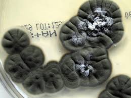 Attēlu rezultāti vaicājumam “Coleosporium sp.”