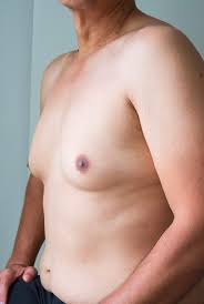 Image result for manboobs