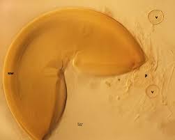 Attēlu rezultāti vaicājumam “Diderma globosum spores”