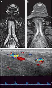Image result for University of Sheffield Ultimate- Phat 'eds