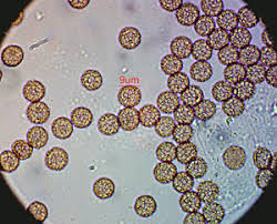 Attēlu rezultāti vaicājumam “Stemonitopsis amoena”