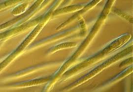 Attēlu rezultāti vaicājumam “Cyanophyta”