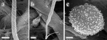 Attēlu rezultāti vaicājumam “Trichia crateriformis spores”