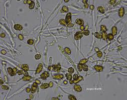 Attēlu rezultāti vaicājumam “Chaenotheca chlorella”