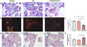 Attēlu rezultāti vaicājumam “Enteridium variabile plasmodium”