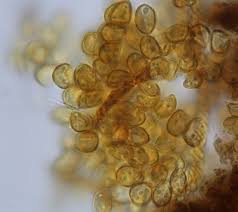 Attēlu rezultāti vaicājumam “Trichia contorta”