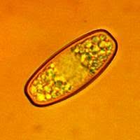 Attēlu rezultāti vaicājumam “Sarcoscypha austriaca var. lutea”