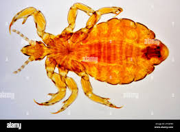 Attēlu rezultāti vaicājumam “Pediculus humanus capitis”