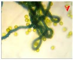 Attēlu rezultāti vaicājumam “Hemitrichia serpula spores”