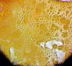 Attēlu rezultāti vaicājumam “Heterotrichia pomiformis (syn. Arcyria pomiformis) macro”