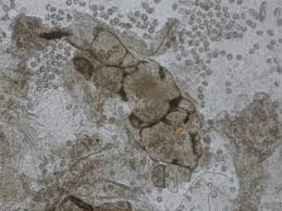 Attēlu rezultāti vaicājumam “Lycogala succineum macro”