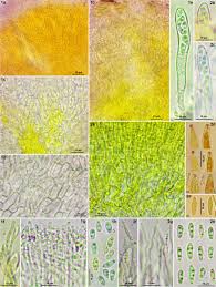Attēlu rezultāti vaicājumam “Trilophozia quinquedentata”
