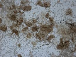 Attēlu rezultāti vaicājumam “Lycogala roseosporum sessile”