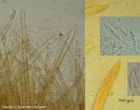 Attēlu rezultāti vaicājumam “Lachnum corticale”