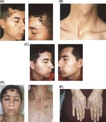 Image result for Lewandowsky-Lutz