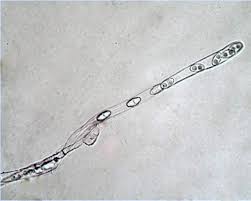 Attēlu rezultāti vaicājumam “Otidea onotica”