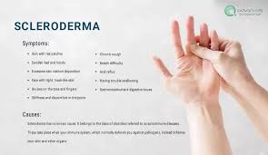Attēlu rezultāti vaicājumam “Scleroderma”